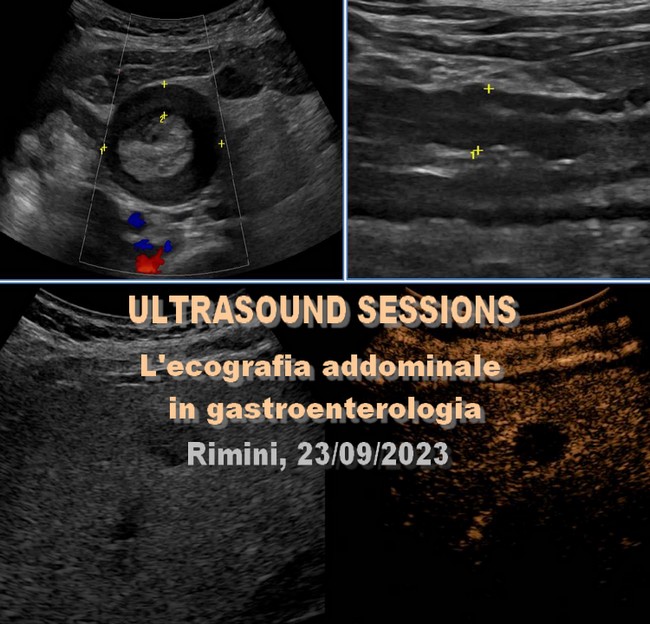 ULTRASOUND SESSIONS – L’ecografia addominale in gastroenterologia, Rimini 23/09/2023 